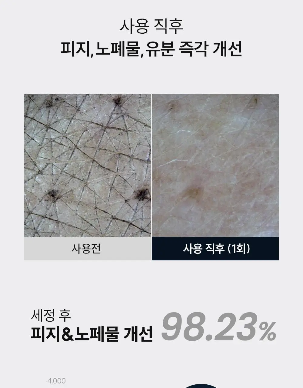 [등드름/체취케어] 낫포유 지성피부전용 등드름/가드름 클리어 올인원 바디워시 포맨 500ml 상세페이지 33